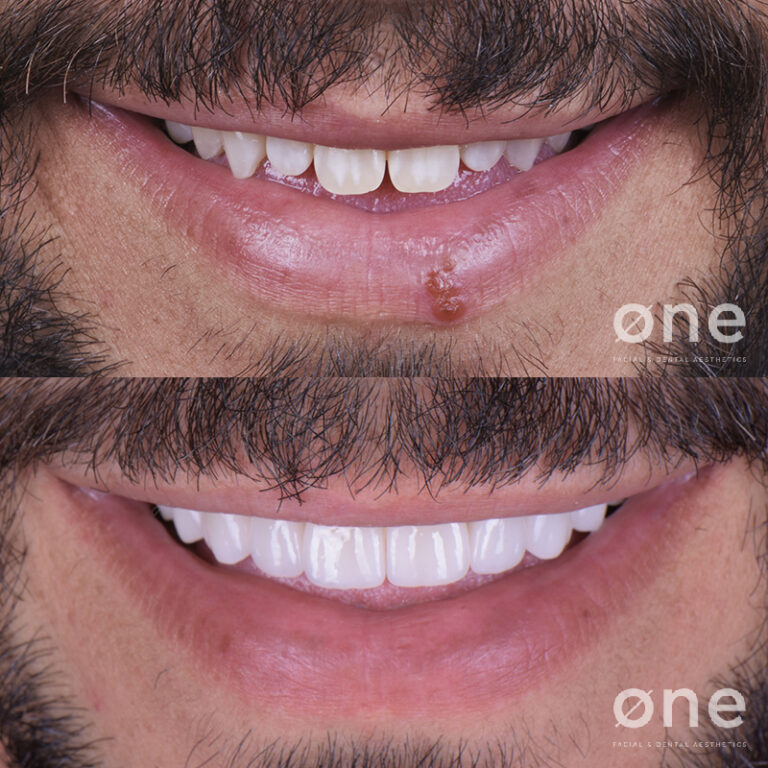 clinica-dental-marbella-one-clinic12