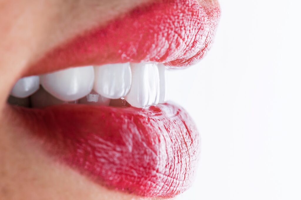 Estética Dental