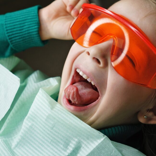 Odontología infantil en Marbella