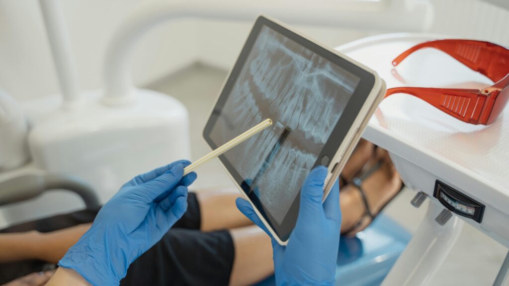 Mejor clínica dental en Marbella para implantes dentales