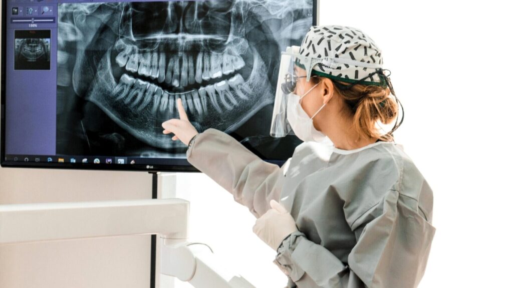Mejor clínica dental en Marbella para implantes dentales